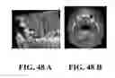 Fig. 49 - System and method for the design, creation and installation of implant-supported dental prostheses