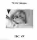 Fig. 50 - System and method for the design, creation and installation of implant-supported dental prostheses