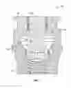 Fig. 02 - Fixed hybrid dental attachment assembly and methods of use