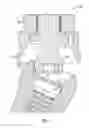 Fig. 05 - Fixed hybrid dental attachment assembly and methods of use