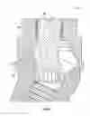 Fig. 06 - Fixed hybrid dental attachment assembly and methods of use