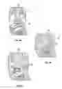 Fig. 07 - Fixed hybrid dental attachment assembly and methods of use