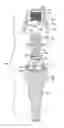 Fig. 18 - Fixed hybrid dental attachment assembly and methods of use