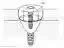 Fig. 01 - DENTAL IMPLANT SYSTEM