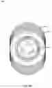 Fig. 09 - DENTAL IMPLANT SYSTEM