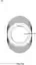 Fig. 45 - DENTAL IMPLANT SYSTEM
