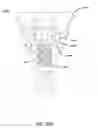 Fig. 51 - DENTAL IMPLANT SYSTEM