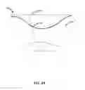 Fig. 52 - DENTAL IMPLANT SYSTEM