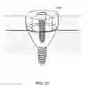 Fig. 55 - DENTAL IMPLANT SYSTEM