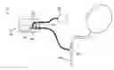 Fig. 01 - Body Tissue and Vessel Compression Valve Apparatus