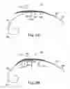 Fig. 03 - Intravascular devices and delivery systems and uses thereof