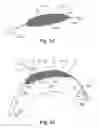 Fig. 04 - Intravascular devices and delivery systems and uses thereof