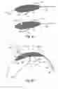 Fig. 05 - Intravascular devices and delivery systems and uses thereof