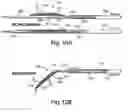Fig. 10 - Intravascular devices and delivery systems and uses thereof