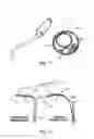 Fig. 11 - Intravascular devices and delivery systems and uses thereof