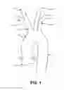 Fig. 02 - Intravascular blood filter