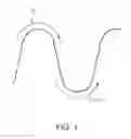 Fig. 02 - Elastic stent graft