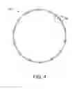 Fig. 06 - Elastic stent graft