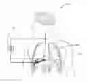 Fig. 01 - Artificial diaphragm having intelligent nanomagnetic particles for treatment of diaphragmatic paralysis