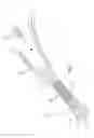 Fig. 02 - Connector for attaching tissue to bone