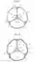Fig. 03 - Inverted leaflet prosthetic valve