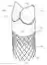 Fig. 01 - Low-profile heart valve and delivery system