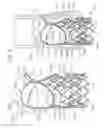 Fig. 02 - Low-profile heart valve and delivery system