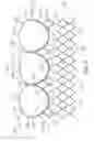 Fig. 03 - Low-profile heart valve and delivery system