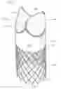Fig. 06 - Low-profile heart valve and delivery system