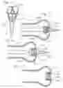 Fig. 10 - Low-profile heart valve and delivery system