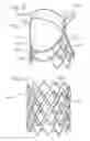 Fig. 12 - Low-profile heart valve and delivery system