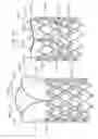 Fig. 13 - Low-profile heart valve and delivery system