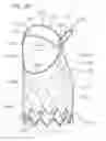 Fig. 15 - Low-profile heart valve and delivery system