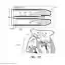 Fig. 03 - MINIMALLY-INVASIVE DELIVERY SYSTEMS