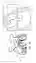 Fig. 04 - MINIMALLY-INVASIVE DELIVERY SYSTEMS