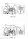 Fig. 05 - MINIMALLY-INVASIVE DELIVERY SYSTEMS