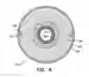 Fig. 17 - MINIMALLY-INVASIVE DELIVERY SYSTEMS
