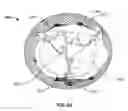 Fig. 13 - Prosthetic mitral valve