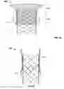 Fig. 14 - Prosthetic mitral valve