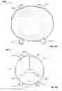 Fig. 20 - Prosthetic mitral valve