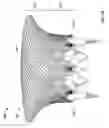 Fig. 23 - Prosthetic mitral valve
