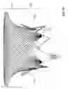 Fig. 24 - Prosthetic mitral valve
