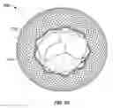 Fig. 25 - Prosthetic mitral valve