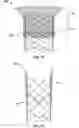 Fig. 27 - Prosthetic mitral valve