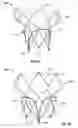 Fig. 30 - Prosthetic mitral valve