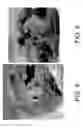 Fig. 06 - Osteo-implant