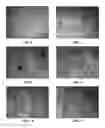 Fig. 06 - 3D printed trans-modular scaffolds for grafting applications in segmental bone defects
