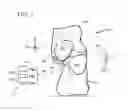 Fig. 04 - System and method for non-binding allograft subtalar joint implant
