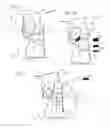 Fig. 06 - System and method for non-binding allograft subtalar joint implant
