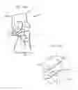 Fig. 08 - System and method for non-binding allograft subtalar joint implant